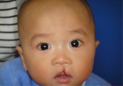 全自动星空体育解析缺锌到底会不会引起缺陷-山东国康