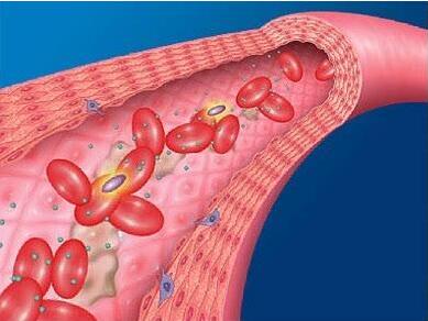 【小满来了】！医用星空体育厂家提供几种食物清除你的血液垃圾！